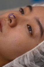 Nonton Film Plastic Beauty Season 1 Episode 4 Sub Indo
